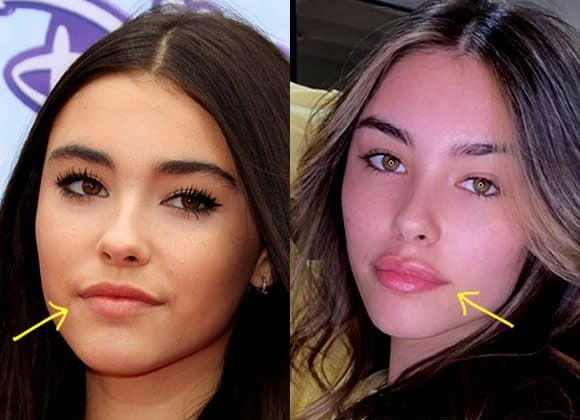 Madison Beer Shows “Proof” She Didn’t have Plastic Surgery After Rumors